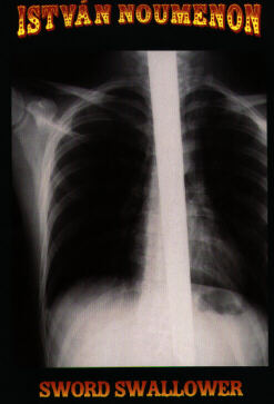 X-ray of Istvan Betyar