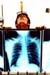 Brad Byers X-Ray