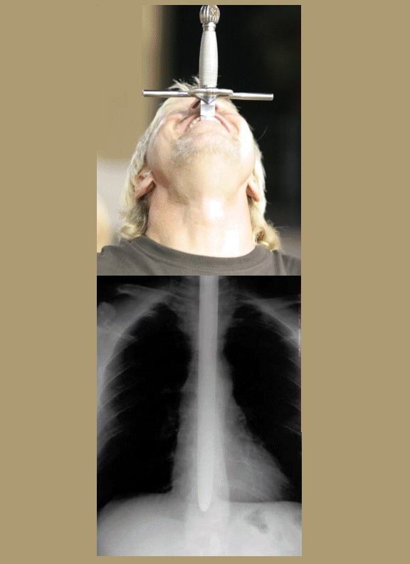 X-ray of Dan Meyer