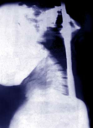 X-ray of Daniel Mannix 1949